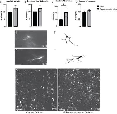 Prenatal Exposure to Gabapentin Alters the Development of Ventral Midbrain Dopaminergic Neurons